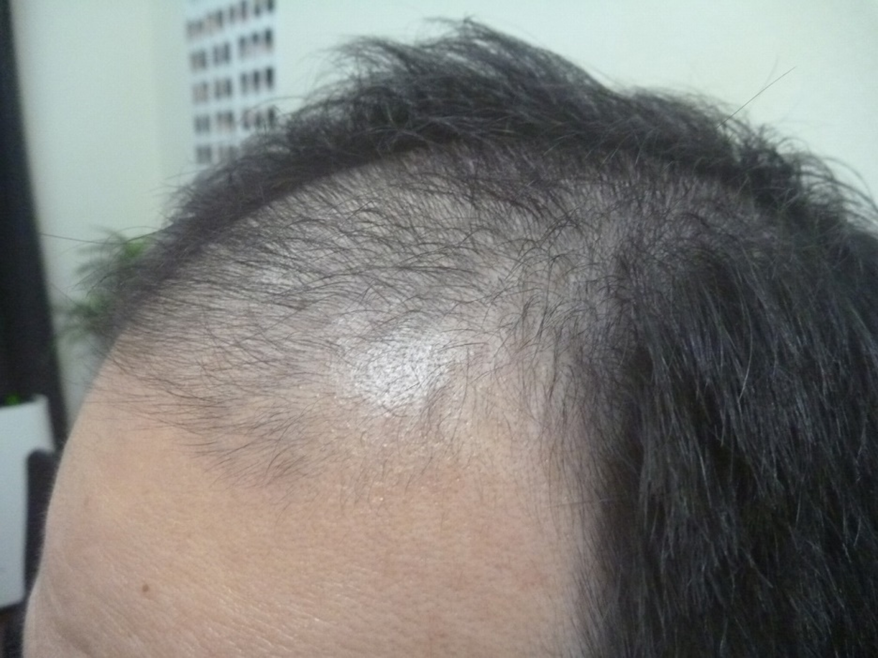 Before 40代男性