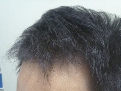 After 40代男性