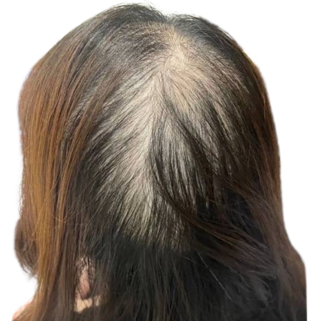 40代女性 後頭部 スタート
