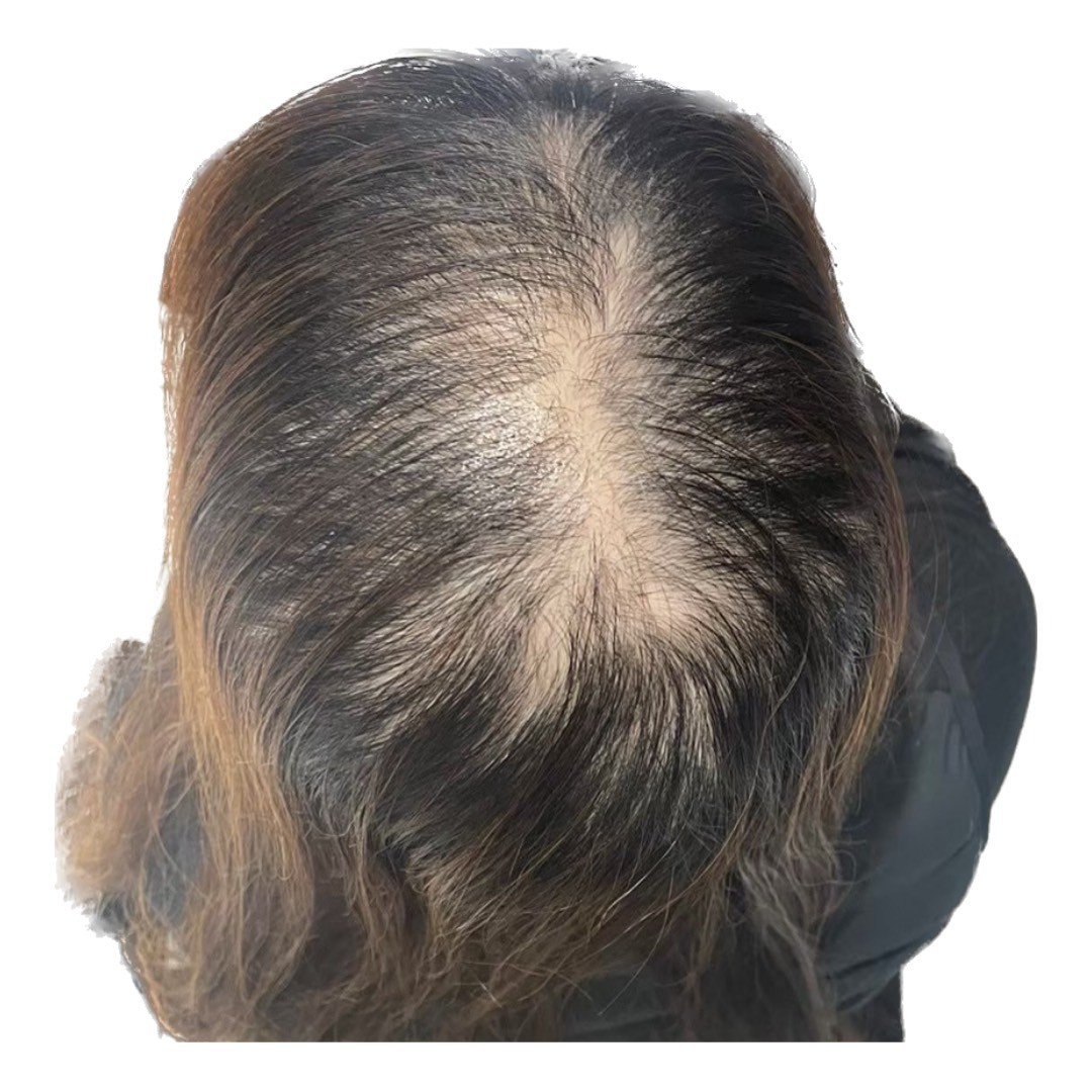 Before 40代女性
