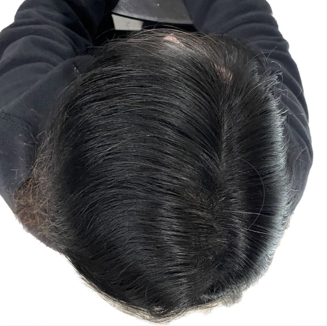 After 40代女性