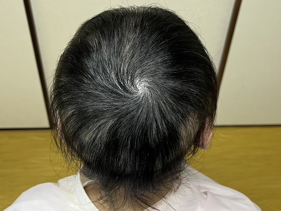 30代女性 つむじ 途中
