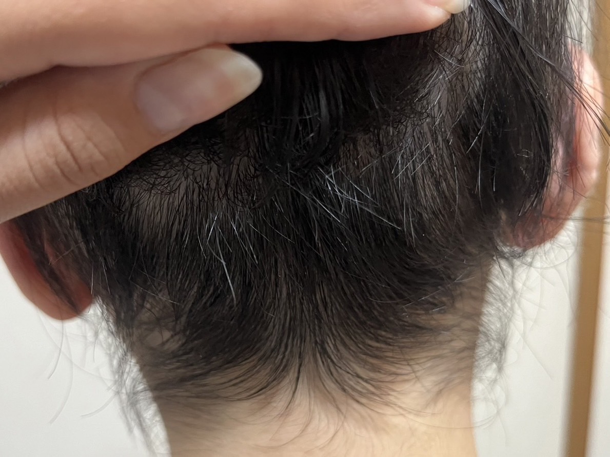 30代女性 後頭部 途中