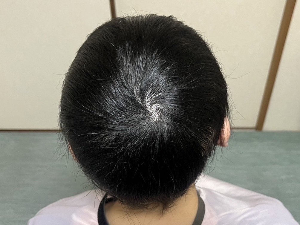 After 30代女性