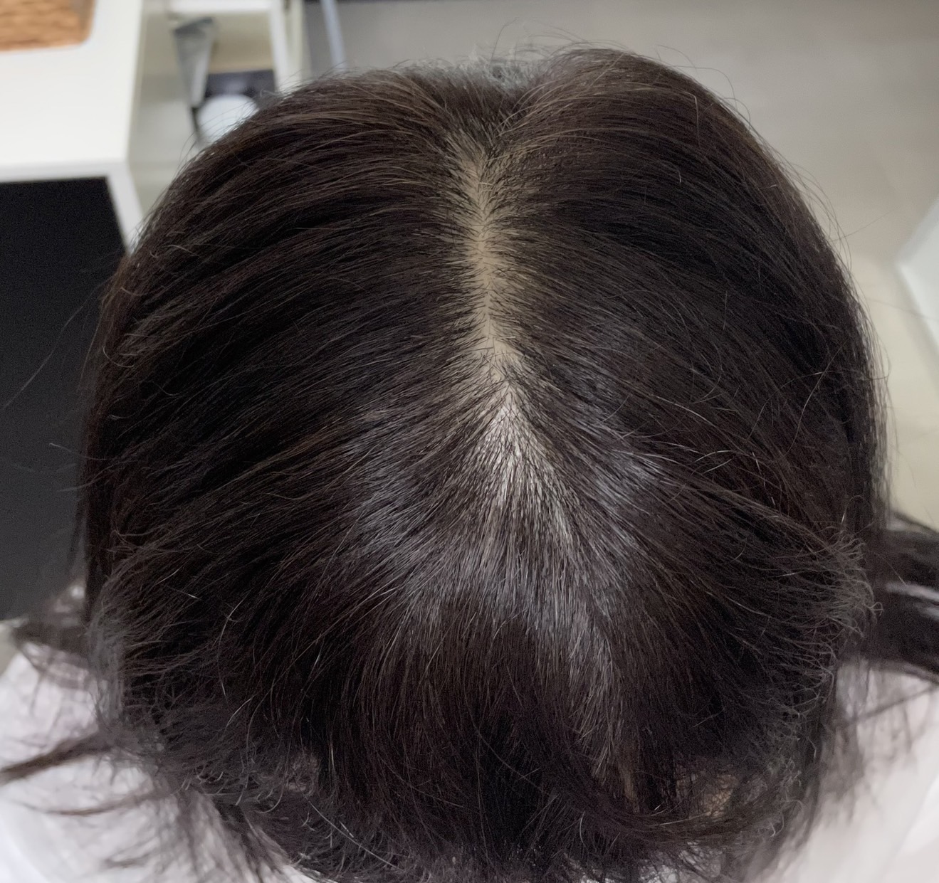 50代女性 分け目 7ヵ月