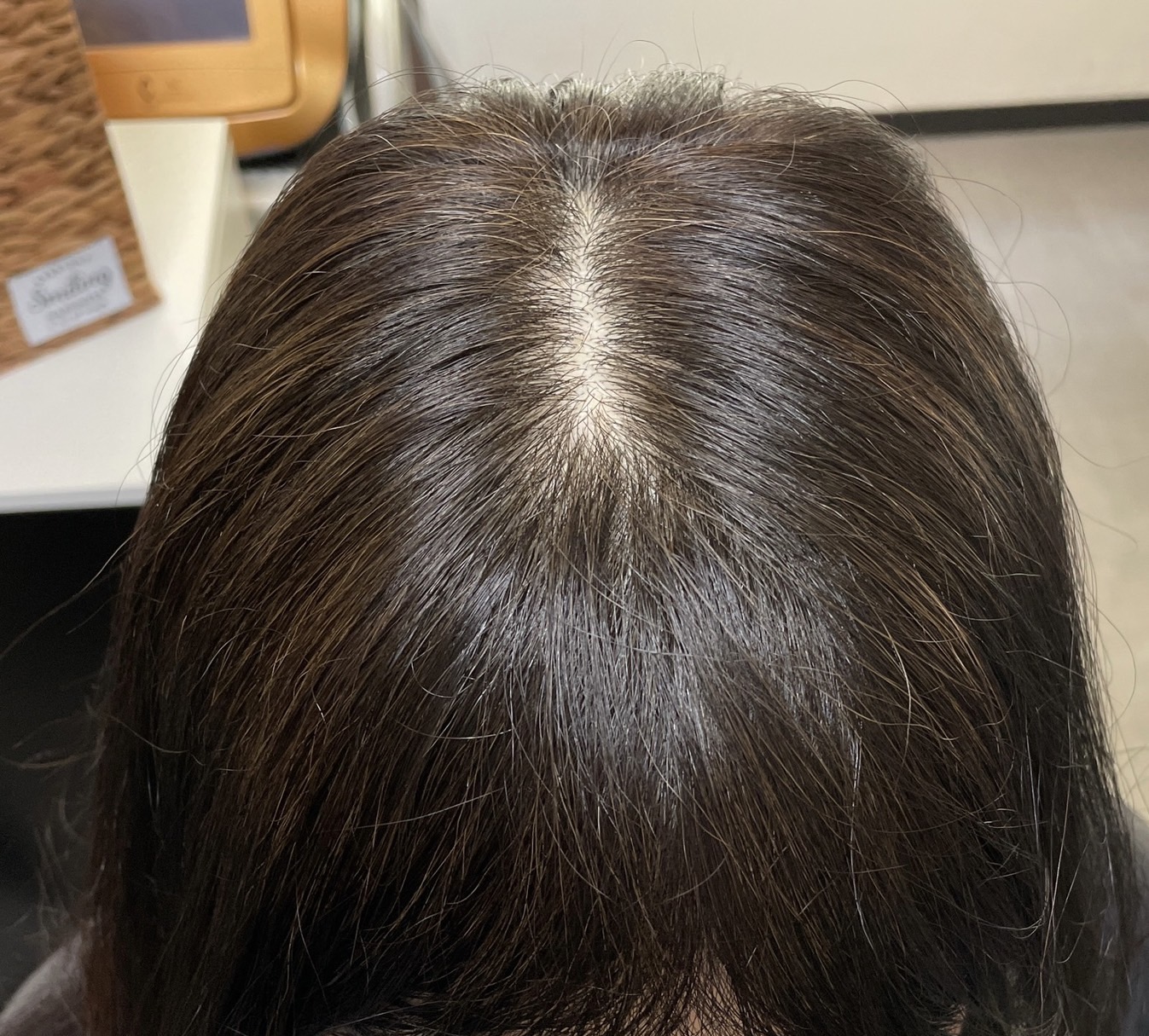 50代女性 分け目 3ヵ月