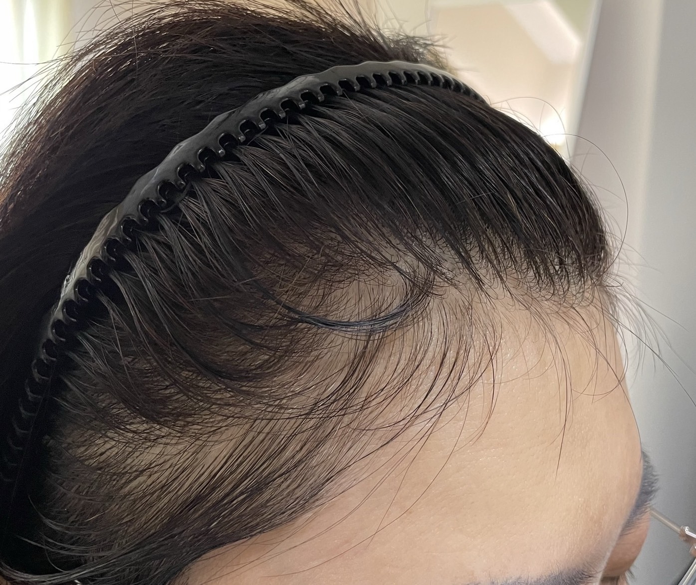 50代女性 生え際 3ヵ月